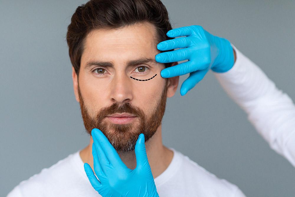 eyelid surgery