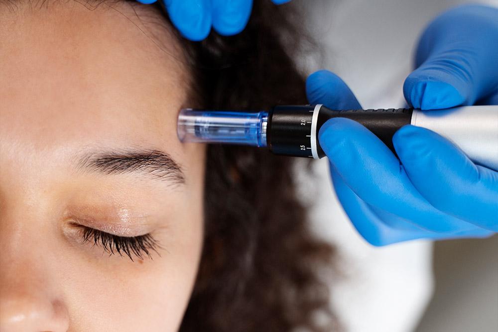 Dermal Filler