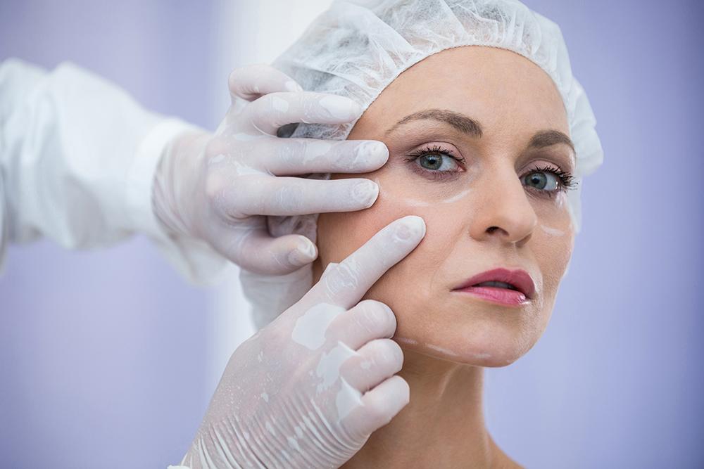 Breast Augmentation