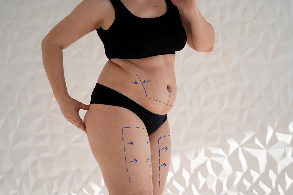 Survey Shows ASAPS