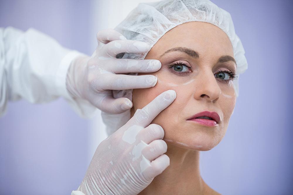 Risk Factor for Complications after Facelift