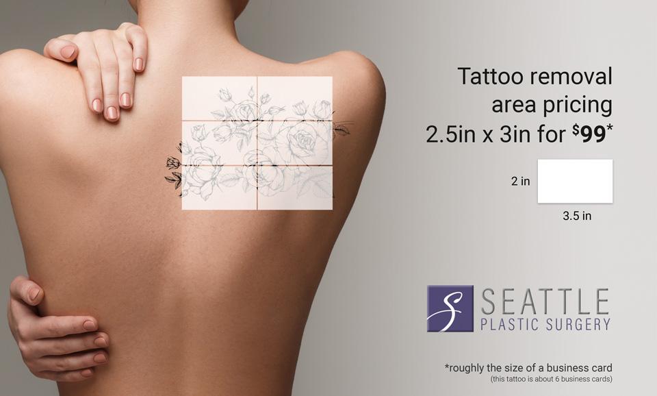 Image of Tattoo Removal pricing - Seattle Plastic Surgery