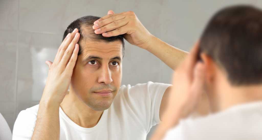 Hair Restoration In Seattle and Tacoma