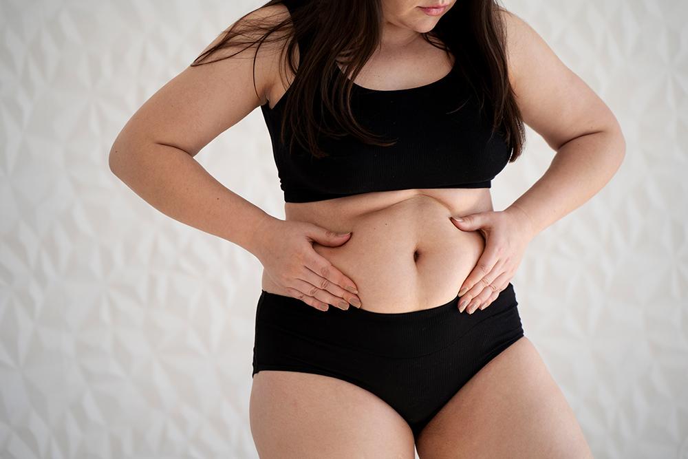 weight loss after breast reduction