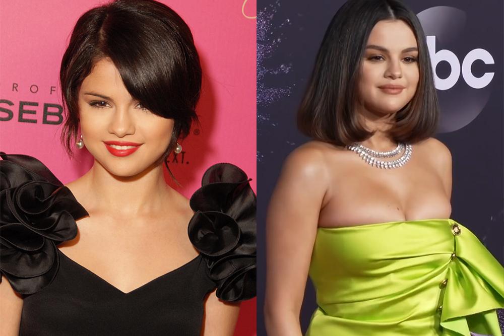 Selena Gomez Breast Augmentation