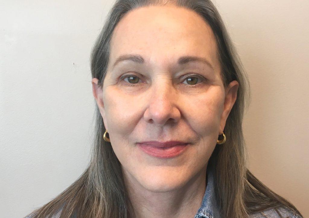 An After Photo of a Facelift Plastic Surgery by Dr. David Santos in Seattle and Tacoma