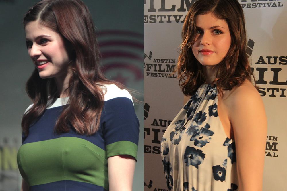 Alexandra Daddario's Breast Augmentation