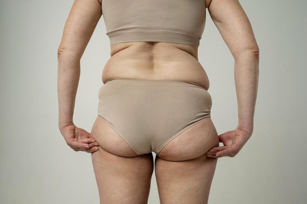 Modal showing Vaser Liposuction