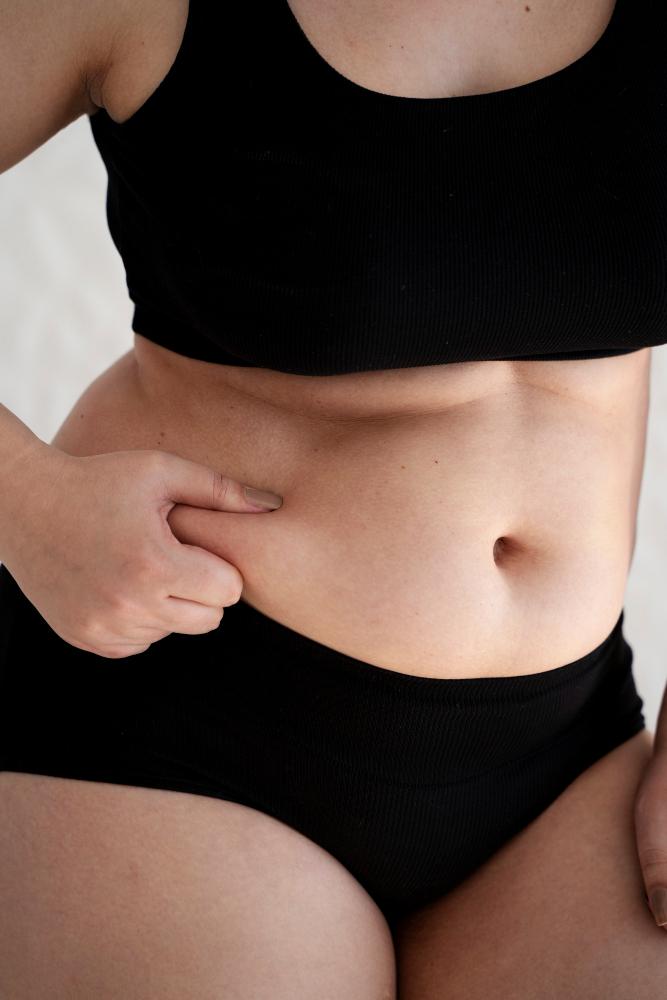 GOOD CANDIDATES FOR TUMMY TUCK SURGERY