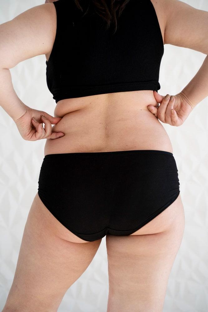 Modal showing Vaser Liposuction