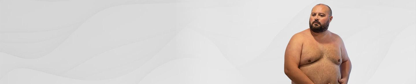 Male Chest Reduction Banner