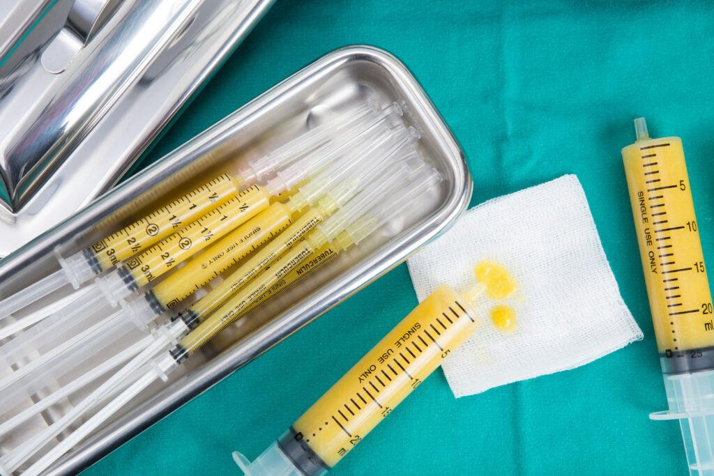 Nano Fat Hair Restoration