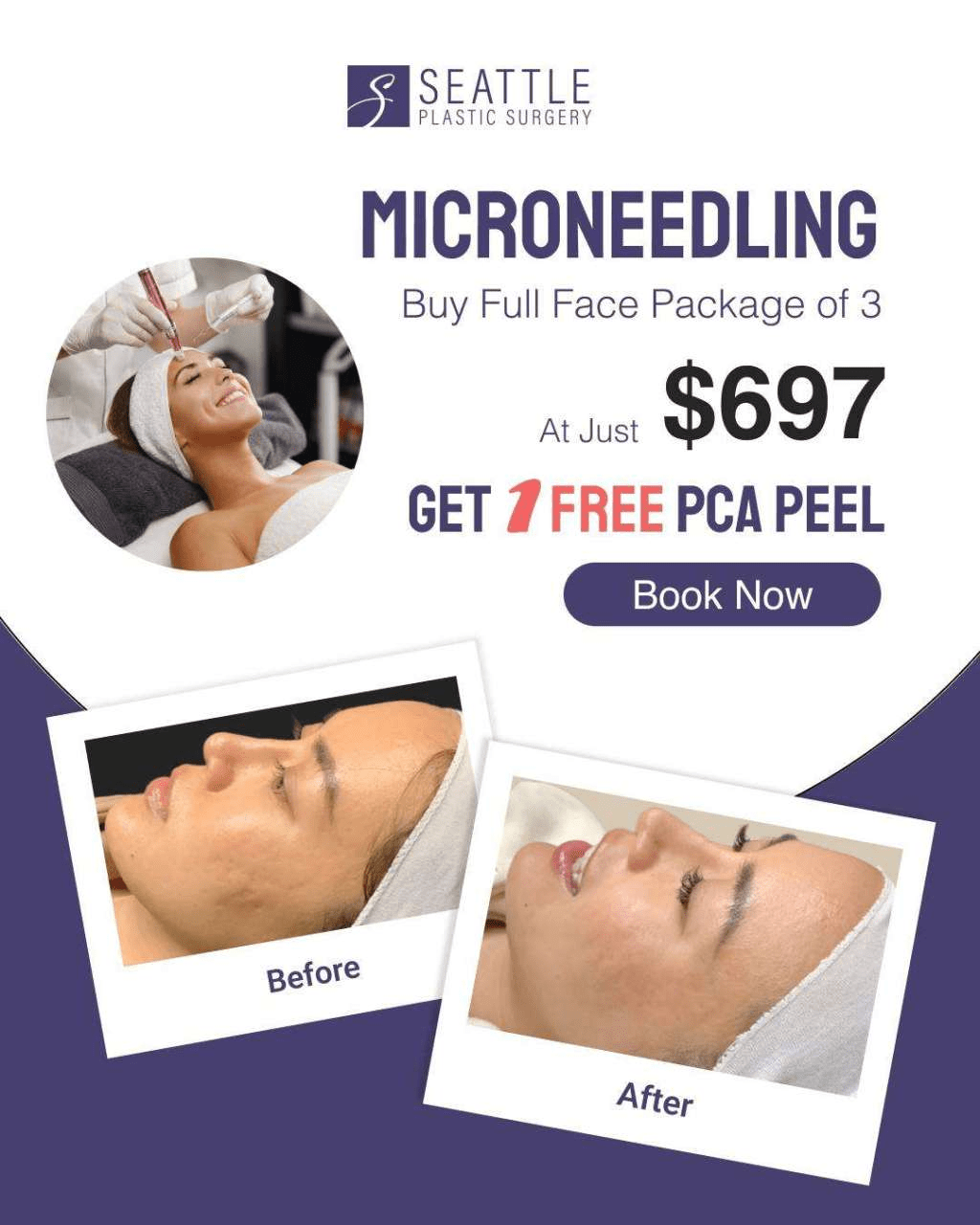 Seattle Plastic Surgery's Best Monthly Specials