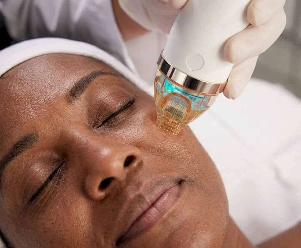 Cutera Secret RF Microneedling Cost in Seattle