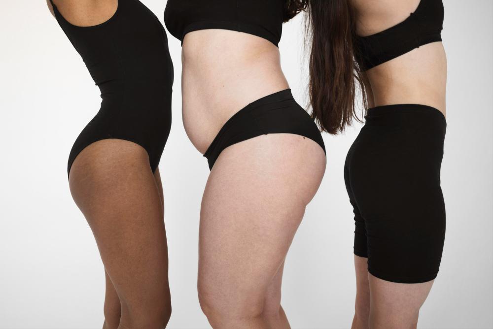 Tummy Tuck Cost in Seattle