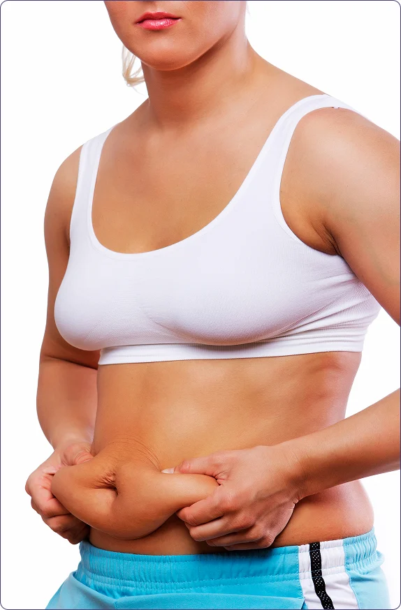 GOOD CANDIDATES FOR TUMMY TUCK SURGERY IN SEATTLE