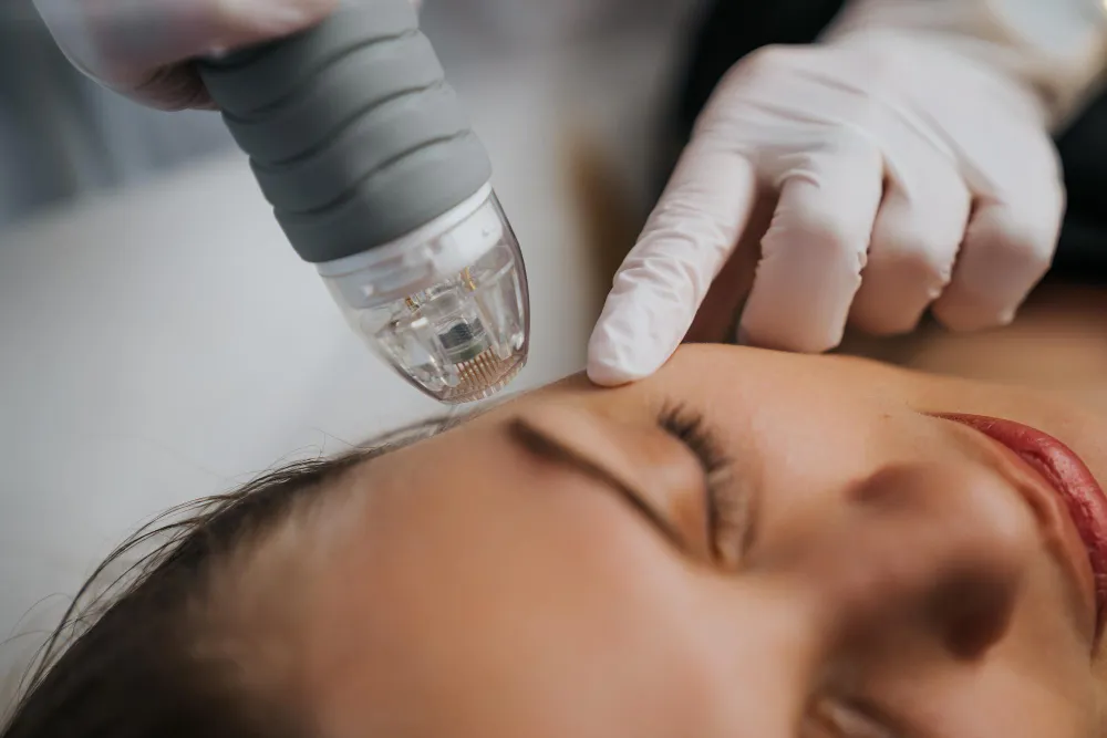 Why Patients Are Combining Rejuran with Microneedling