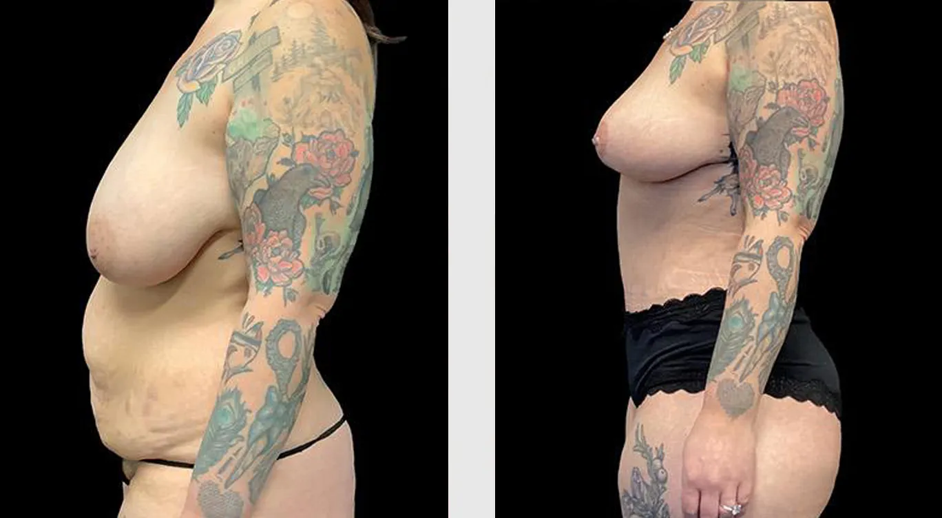 Before and After 02