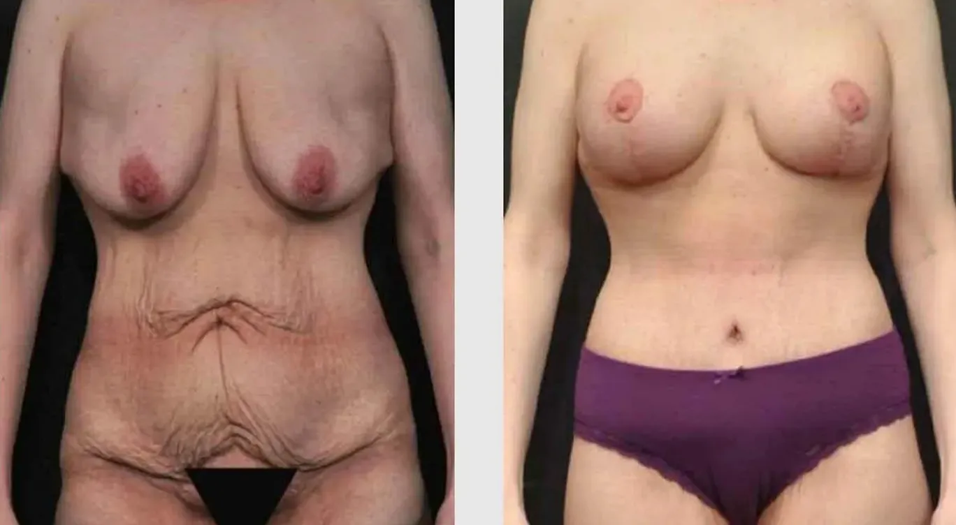Before and After 03